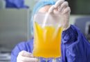 L’iniziativa della SC Medicina Trasfusionale: all’IRCCS AOU AL quattro sabati per donare il plasma